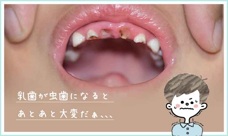 歯の黄ばみが気になる方へ