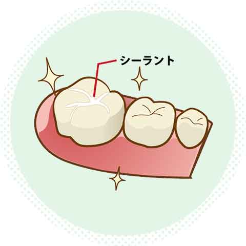 シーラント