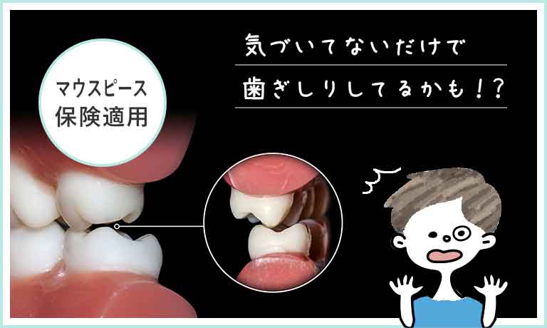 歯ぎしり対策にマウスピースを