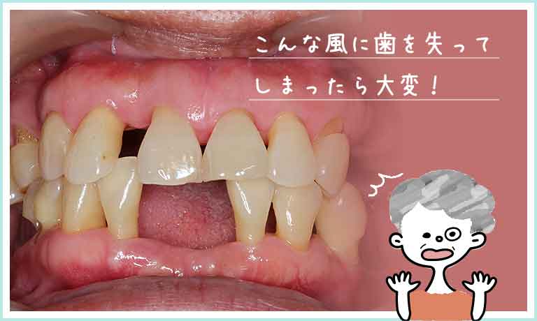 中高年によく起こるトラブルを事前に理解しておきましょう！