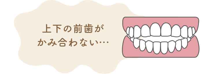 開咬