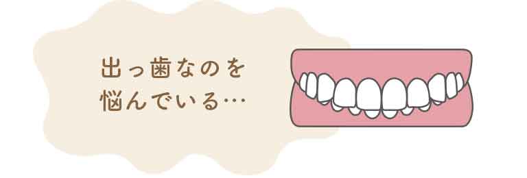 上顎前突