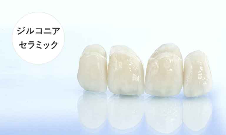 ジルコニアセラミック