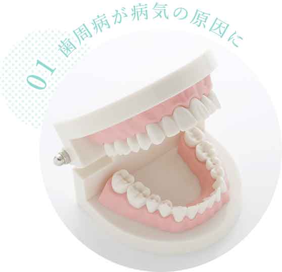 歯が悪いと体調が悪くなりやすい